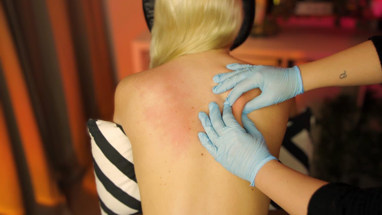 Skin Cracking preview image